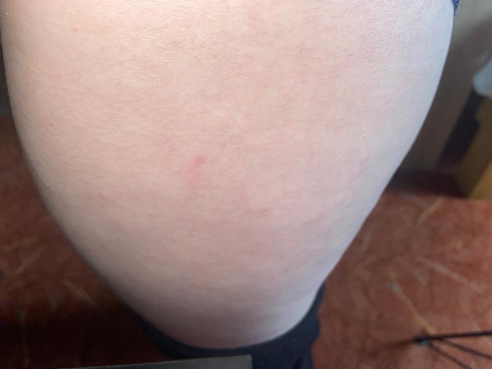 Body Serum Seins & Hanches - Customer Photo From Lisa